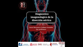 Diagnóstico imagenológico de la disección aórtica [upl. by Yrellav]