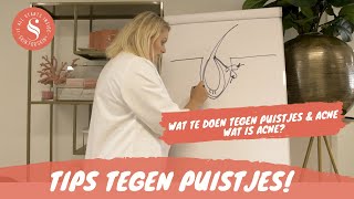 Wat te doen tegen acne en puistjes Hoe ontstaat acne amp tips tegen acne [upl. by Oiligriv223]