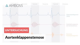 Aortenklappenstenose  Herzgeräusch  AMBOSS Video [upl. by Poppy]