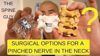 CERVICAL STENOSIS RADICULOPATHY  PART 3  SURGICAL OPTIONS [upl. by Gascony830]