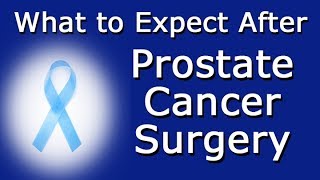 What to Expect After Prostate Cancer Surgery [upl. by Karon303]