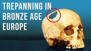 Are These Skulls Evidence of Bronze Age Brain Surgery [upl. by Ani]