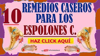 10 Remedios Caseros Para Los Espolones [upl. by Lledor]