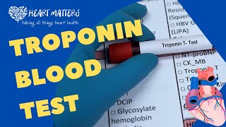 All About the Troponin Blood Test [upl. by Aisirtap711]