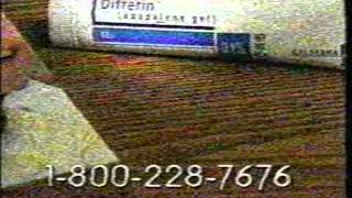 Summer Music Experience Promo  Differin Gel  First PREMIER Bank Commercial Break Pt2 2000 [upl. by Stokes629]