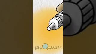 🔍 Insulin Pen Use Explained PreOp shorts Diabetes  PreOp® Patient Education Pt 3 [upl. by Murtha]