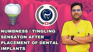 Dr Rudra Mohan  Neurosensory Disturbances After Dental Implant Placement  Numblness  Tingling [upl. by Aggappera]