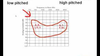 How to Read an Audiogram  Watch this Video Before You Buy Hearing Aids [upl. by Ferrigno186]