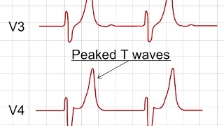 Cardiac Conduction System and Understanding ECG Animation [upl. by Bautram]