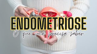 Fatores de Risco da Endometriose [upl. by Myrtle]