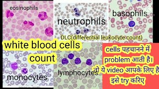 blood test differencial leukocytes count  DLC count sabse sahi tarika I dlc count in microscope [upl. by Fantasia]