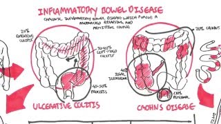 Inflammatory Bowel Disease  Crohns and Ulcerative Colitits [upl. by Marlea]