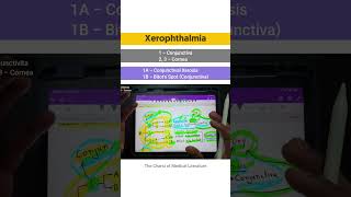 Xerophthalmia  Vitamin A deficiency tcml shorts shortsyoutube [upl. by Dloreh]