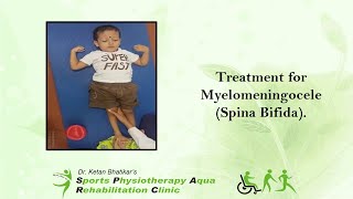 Treatment for myelomeningocele Spina Bifida [upl. by Mirna630]