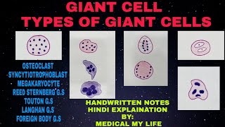 GIANT CELL  Types of Giant Cells  Pathology [upl. by Ursuline]