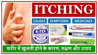 ITCHING शरीर में खुजली होने के कारण लक्षण और उपाय CAUSES SYMPTOMS MEDICINES FOR ITCHING ON SKIN [upl. by Clarkin]