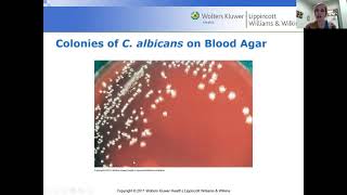 Microbiology  fungi lecture [upl. by Lorrimor]