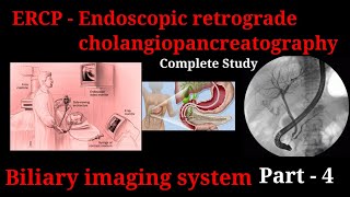 ERCP Procedure  Endoscopic retrograde cholangiopancreatography  biliary imaging system part 3 [upl. by Karalee]