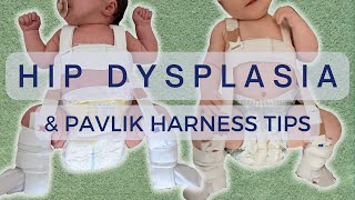 PAVLIK HARNESS AND HIP DYSPLASIA IN NEWBORNS  CARING FOR A BABY IN A PAVLIK HARNESS [upl. by Yokoyama]