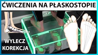 Ćwiczenia na płaskostopie 👣 KOREKCJA STOPY PŁASKIEJ wylecz wadę postawy TRENING MEDYCZNY [upl. by Dita894]