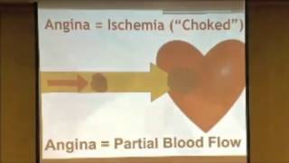 CME4LIFE  12 Lead EKG How to Diagnose Ischemia [upl. by Imyaj]