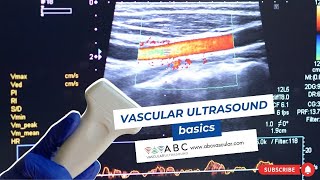 Vascular ultrasound basics [upl. by Gabbie797]