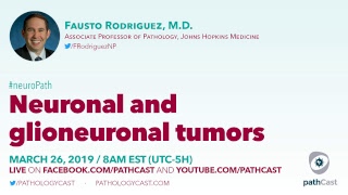 Neuronal and glioneuronal tumors  Dr Rodriguez Hopkins NEUROPATH [upl. by Anyer]