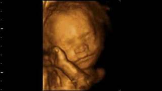 Baby 4D Ultraschall Kopf 3D Bauch Kind 28 SSW ultrasound [upl. by Ientruoc]