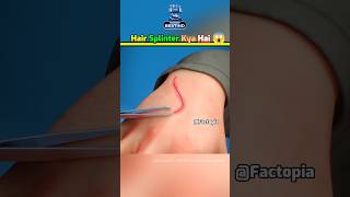 Remove Hair Splinter Immediately ⚠️ shorts fact splinter [upl. by Naejeillib]