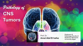 CNS Brain TumorsNeoplasms شرح محاضرة [upl. by Bolte]