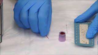 How to Measure the Hematocrit [upl. by Maclaine169]