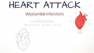 HEART ATTACK Myocardial Infarction [upl. by Eiramannod]