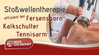 Stoßwellentherapie Effektive Behandlung bei Kalkschulter Fersensporn Tennisarm amp Co [upl. by Mcginnis]