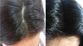 Cabelo Branco Nunca Mais Pinte em Casa com 2 Ingredientes 🌹 MARILENE SARAH FIALHO [upl. by Eseneg]