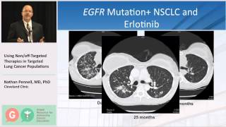 Using NonOffTargeted Therapies in Targeted Lung Cancer Populations [upl. by Marcella]