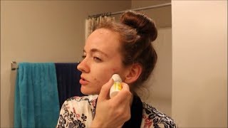 Will Clindamycin Help My Acne [upl. by Conn]