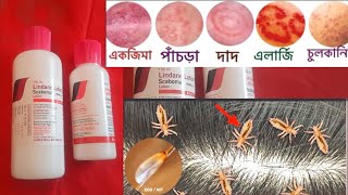 Lindane Lotion U S P  চুলকানি পাচডা ইতাদি বাংলা [upl. by Nairrot]