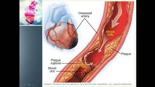 Ischemia  Myocardial Ischemia amp Its causes [upl. by Anirdua]