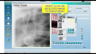 How to Export an Xray Image from Owandy QuickVision to Prof Suni or Apteryx XrayVision [upl. by Leilani]