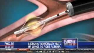 New treatment for asthma [upl. by Nelag]