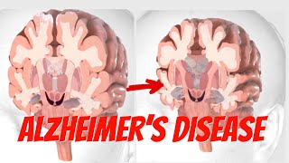 The Anatomy and Physiology of Alzheimer’s Disease Understanding the Brains Changes [upl. by Aneloj]