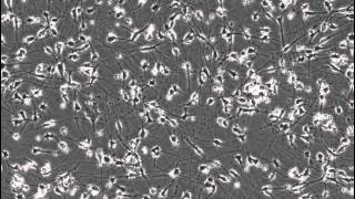 Timelapse of Neurite Outgrowth of Plated iCell® Neurons [upl. by Acissaj709]