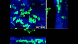 Movie 15 Sequential migration of neutrophils from the epidermisdermis into sites of sand fly [upl. by Tecu]