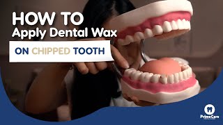 How to apply dental wax on chipped tooth [upl. by Anavi12]