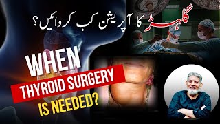 Disease of thyroid Gland When we need surgery  Prof De Javed Iqbal [upl. by Amelie16]