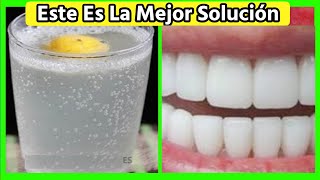 Quita el Sarro de Tus Dientes con 1 Remedio casero hecho por ti mismo [upl. by Llenna]