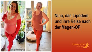 Nina das Lipödem und ihre Reise nach der MagenOP [upl. by Ahsym534]