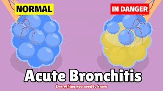 What is Acute Bronchitis  Causes Symptoms Diagnosis amp Treatment [upl. by Luciana]