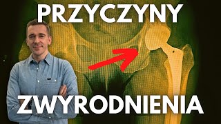 🔴Dlaczego masz zwyrodnienie stawu Główne przyczyny [upl. by Yendis]