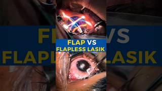 Flap VS Flapless Lasik [upl. by Ymled]